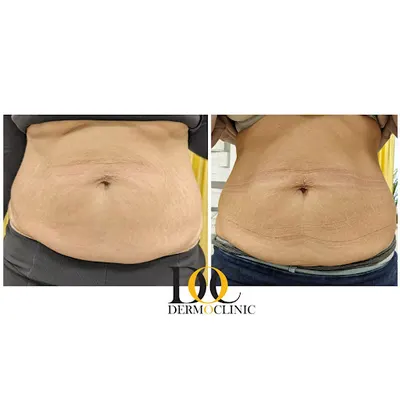 DERMOCLINIC ® - klinika medycyny i kosmetologii estetycznej